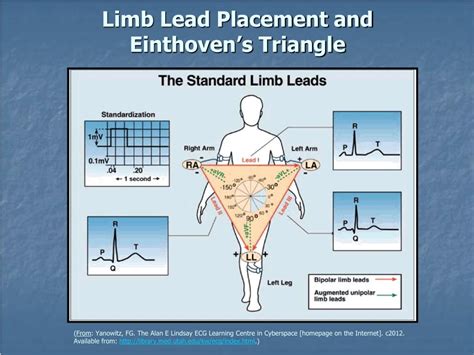 Ppt Introduction To The 12 Lead Ecg Powerpoint Presentation Free