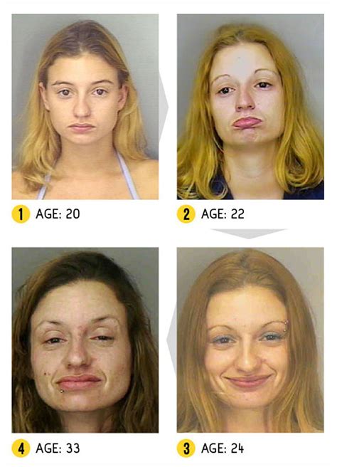 Before And After Pics Of Crystal Meth Users Are Enough To