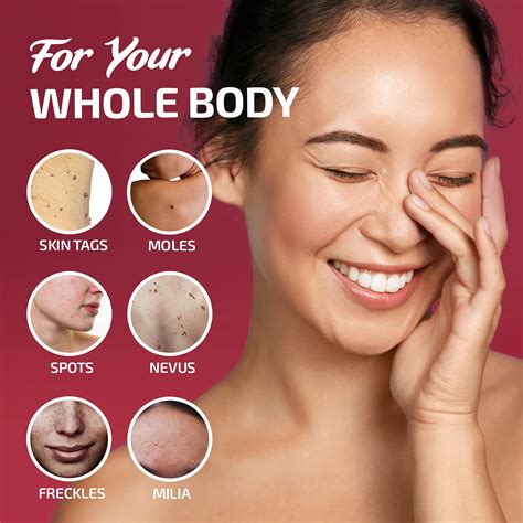 buy dabida extreme skin tag remover advanced skin tag removal cream