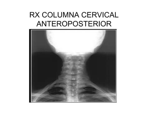 Radiografia Columna Cervical Dorsal Ppt