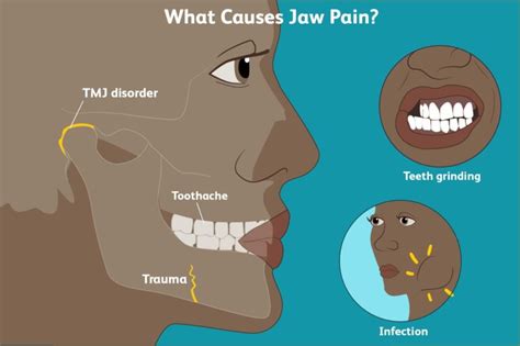 Tooth Pain Causes Symptoms And Treatment Teachforhk