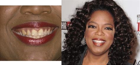 oprah celebrity teeth celebrity smiles big smile celebs celebrities oprah dentistry