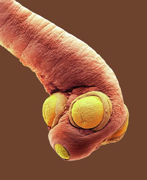 Dog Tapeworm Photograph by Steve Gschmeissner/science Photo Library