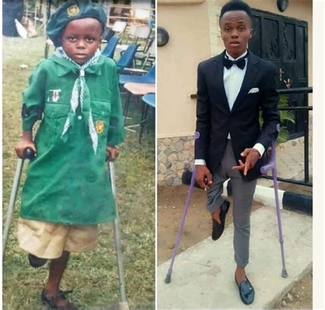 Nigerian Amputee Footballer Reveals How He Became Disabled Kemi Filani