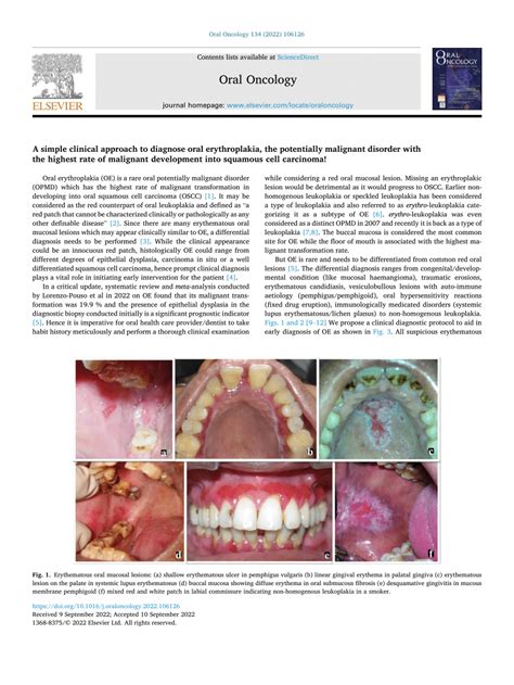 Pdf A Simple Clinicaapproach To Diagnose Oral Erythroplakia The
