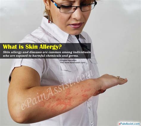 What Is Skin Allergy And How Is It Treated