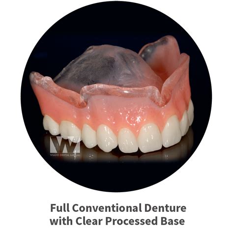 Dental Labs In Arizona Removable And Implant Supported Denture