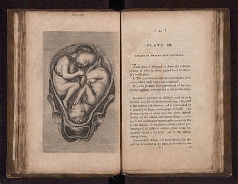 A Collection Of Engravingsmidwifery Wellcome Collection