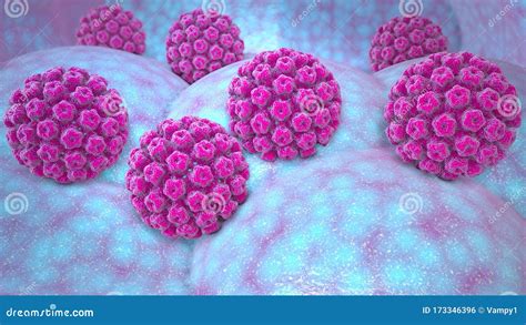 Human Papillomavirus Infection Virus Hpv Is The Most Common Sexually