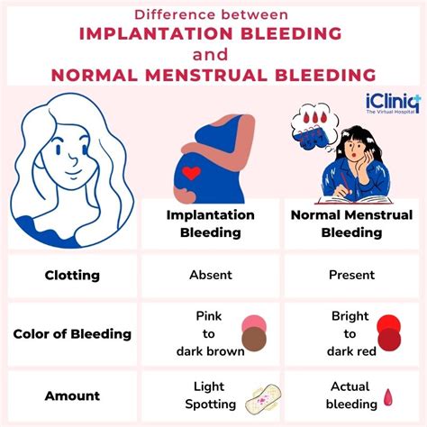 Implantation Bleeding Vs Period Pics