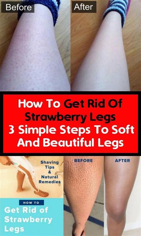 how to get rid of strawberry legs three simple steps to make your legs soft and pretty