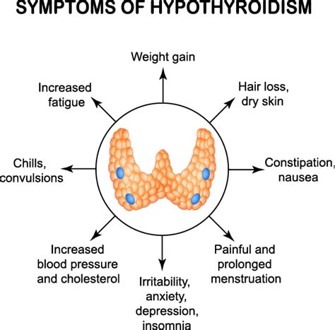 Statistics about how often people on medications for high blood pressure — also known as hypertension — develop hair loss are scarce. Hypothyroidism (Underactive Thyroid) Symptoms, Diagnosis ...