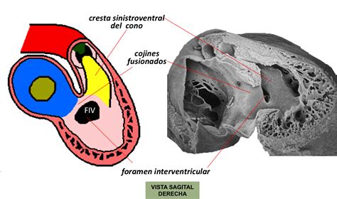 Sos Embriologia Humana Desarrollo De Corazon Foramen Interventricular