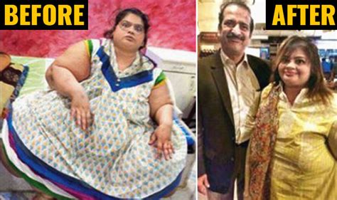 After Former World S Heaviest Woman Eman Ahmed Mumbai Woman Amita Rajani Sheds Kg India Com