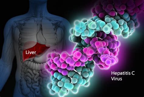 Суммарные антитела к вирусу гепатита с; HCV Ab Negativo e Positivo: Scopri i Valori in caso di ...