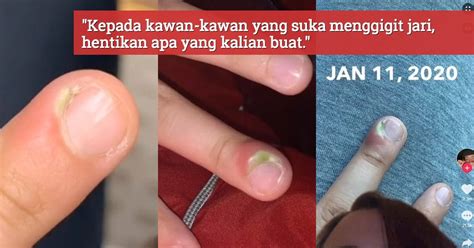 They're the dates beside a word indicate the earliest year for which there is a surviving written record of that word (in. Gara-Gara Tabiat Suka Gigit Kuku, Jari Gadis Ini Bernanah ...