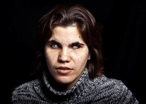 15 Powerful Portraits That Will Change The Way You Think About The Blind