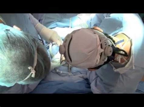 Radical Prostatectomy Surgery What To Expect Youtube
