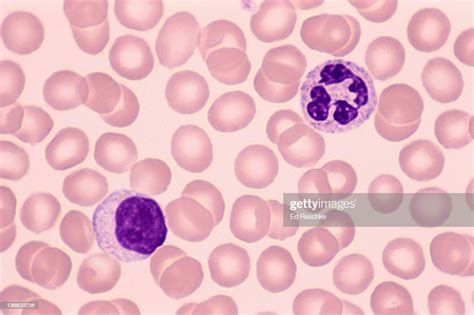 Lymphocyte Neutrophil White Blood Cells Human Blood Stock Photo Getty