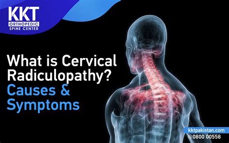 Cervical Radiculopathy Symptoms Causes And Treatments