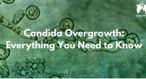 What To Do With Candida Overgrowth Ask Dr Nandi Official Site