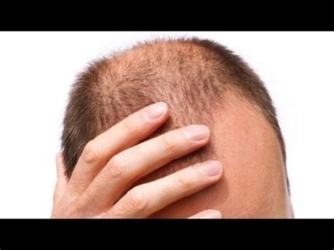 Even after just one wash, my hair is shinier, much less dull and more lively looking. ACV & Cayenne Hair Growth Experiment - YouTube
