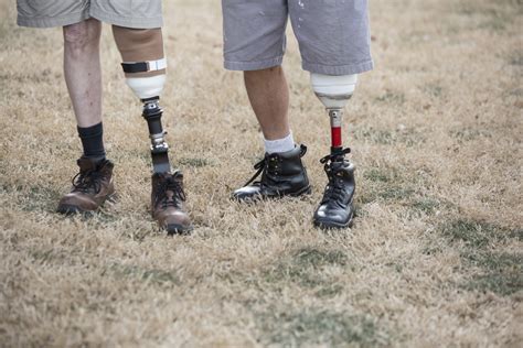 What Everyone Should Know About Prosthetic Legs Premier Prosthetic