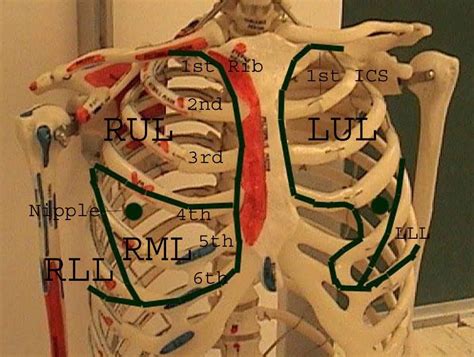 A Practical Guide To Clinical Medicine Nursing Study Lung Lobes