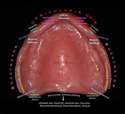 Surrounding Muscles Of Upper Complete Denture Dentistry Dental