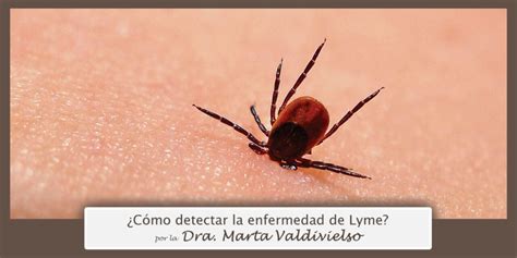 ¿cómo Detectar Enfermedad De Lyme Mipsalud