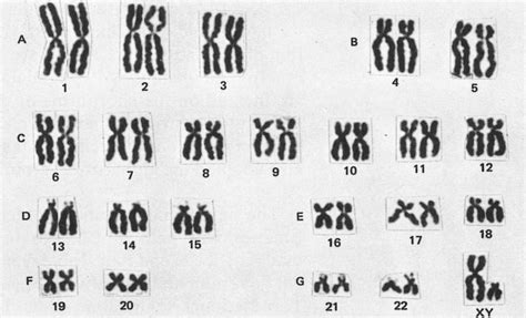 What Is A Karyotypewhat Is A Karyotype What Is A Karyotype