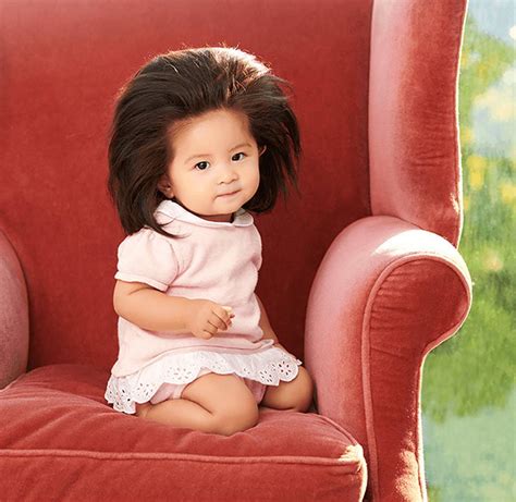 A Rare Medical Condition Made This Baby Born With A Full Head Of Hair An Internet Sensation
