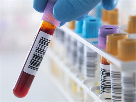 New Blood Screening Method Could Increase Chances Of Ovarian Cancer