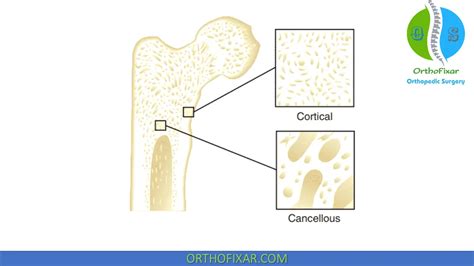 Bone Types Easy Explained Orthofixar 2023