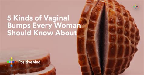 Vaginal Bumps Every Woman Should Know About