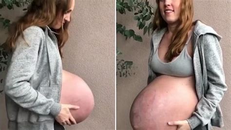 Pregnant With Triplets Belly Growing