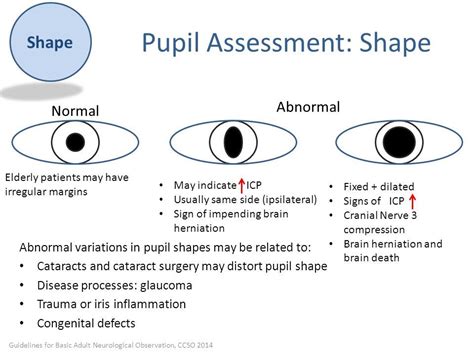 Image Result For Pupil Assessment Cranial Nerve 3