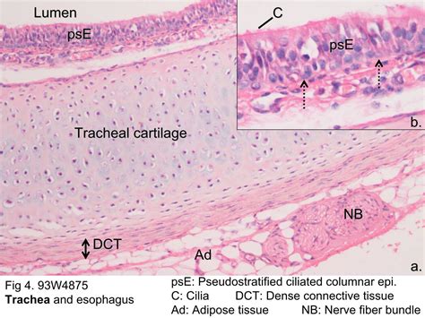 Block1fig 4 The Microscopic Structure Of Trachea