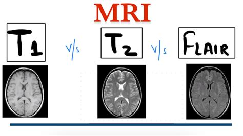 T1 Mri Vs T2 Mri Vs Flair Mri Mri Brain Radiology Youtube