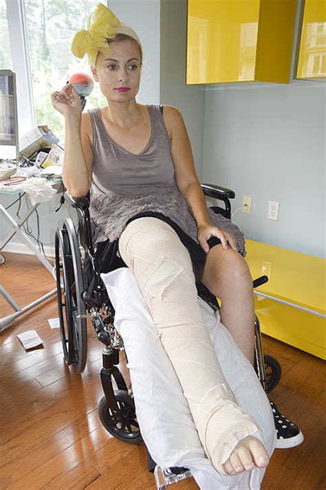 Leg Cast Art Women In Leg Casts Broken Femur Story Wheelchair