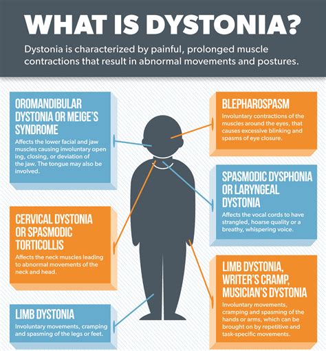 Dystonia In Parkinsons Shake It Up Australia Foundation