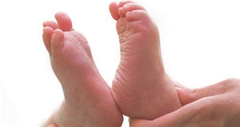 Childrens Foot Problems Burbank Podiatrist Los Angeles Foot