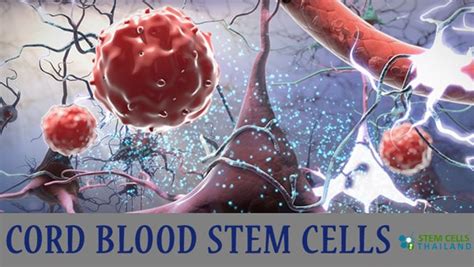 Umbilical cord blood stem cell injections offer the ability to heal damaged tissue naturally. Cord Blood Derived Stem Cells | Page 2
