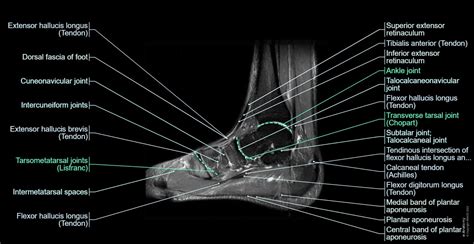 Anatomy Of The Foot And Ankle Mri E Anatomy