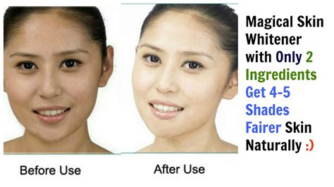 Magical Skin Whitener Only 2 Ingredients Get 4 5 Shades Fairer Skin