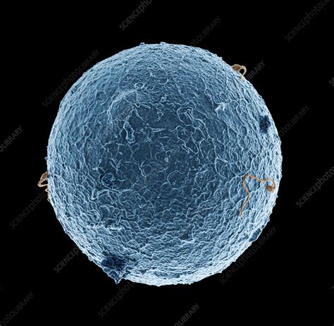 Human Egg Cell And Sperm Cells Esem Stock Image P648 0209 Science Photo Library