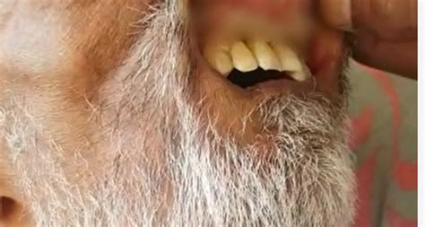 Newspaper front pages from around the world Maggots in mouth: family claims R11m from KZN health department