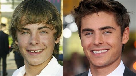 O faustão seguiu o caminho de outros famosos, mesmo após muita resistência, em 2009 faustão fez a cirurgia bariátrica, e chegou a emagrecer 30 bem esta foi a lista dos 8 famosos brasileiros antes e depois do emagrecimento, compartilhe esta postagem assim seus amigos do facebook poderão. Homens que se Cuidam | ANTES E DEPOIS DO SORRISO DOS FAMOSOS