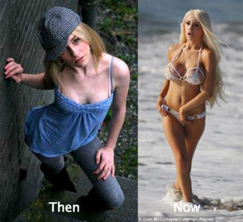 Courtney Stodden Plastic Surgery Before And After Photos