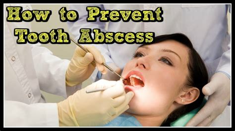 How To Prevent Tooth Abscess Youtube